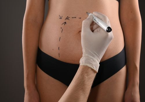 cirugias para bajar de peso