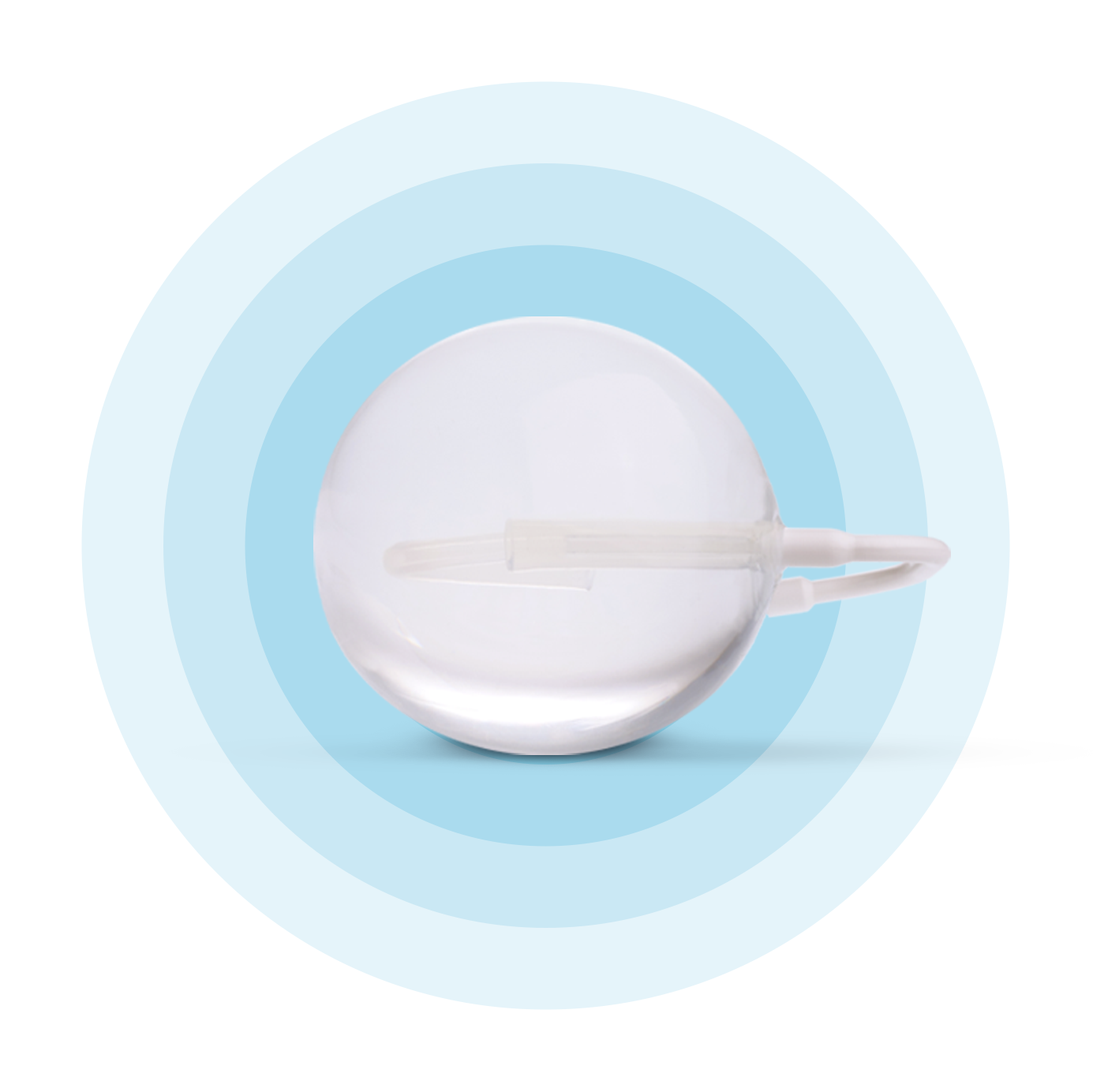 ¿Qué es Spatz3? Balón Gástrico