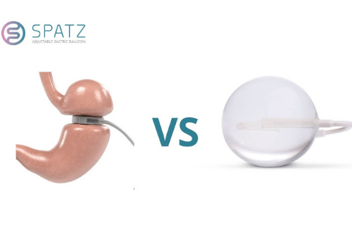 Balón Gástrico Cuánto Cuesta
