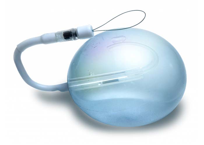 Tipos de balão gástrico e ajustabilidade do Spatz3