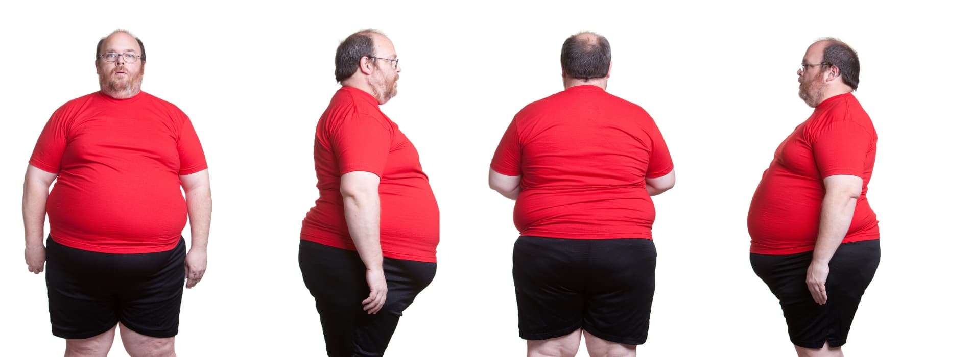 Bmi of male obesity