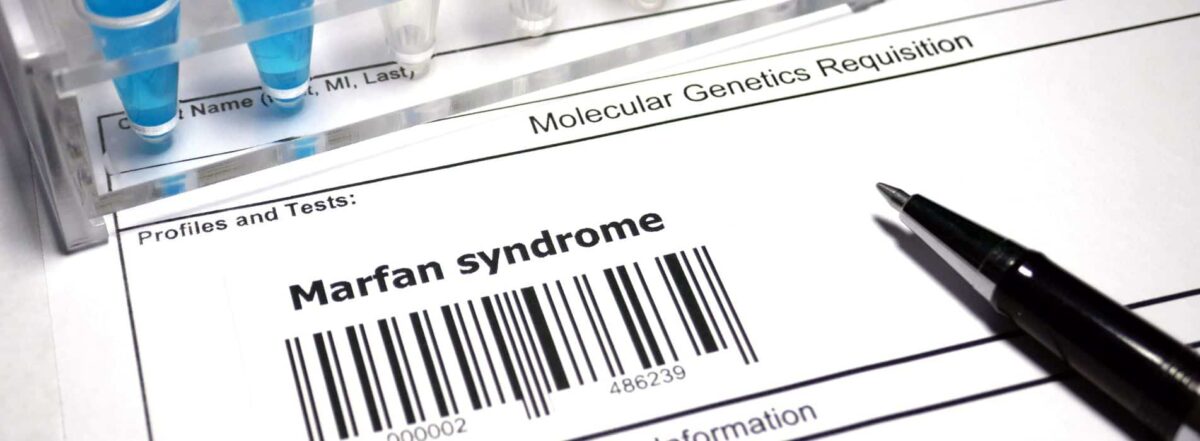 How is Marfan Syndrome Diagnosed