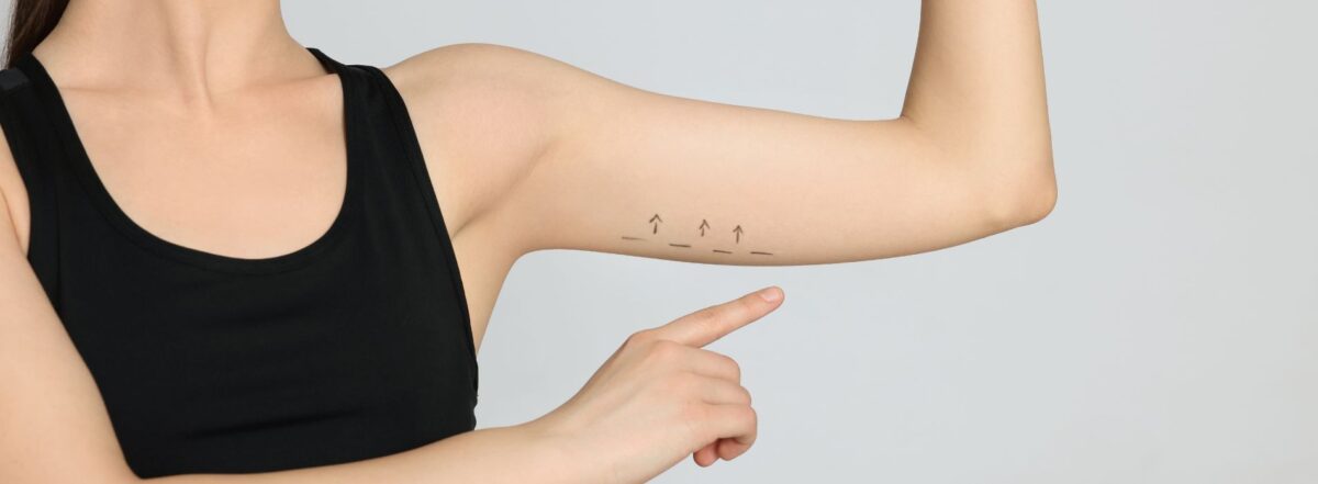 How To Avoid Loose Skin After Weight Loss?