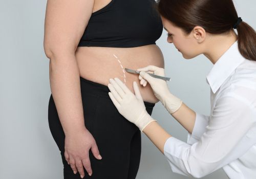 is weight loss surgery safe