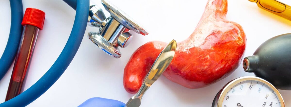 Razones Para No Someterse A Una Cirugía Bariátrica